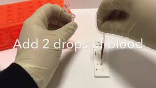 Troponin I Semi Quantitative Rapid Test [upl. by Zak54]