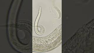 Phylum Aschelminthes Nematoda Roundworms [upl. by Nylg718]