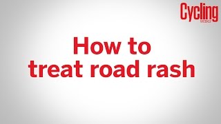 How to treat road rash [upl. by Er]