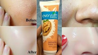 How to Use Face Scrubs  Everyuth ScrubHow to Apply Face Scrub at Home Hindi [upl. by Christiano985]