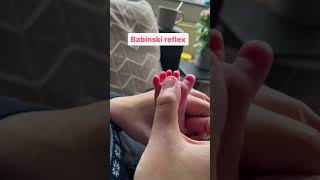 Babinski Reflex psychology [upl. by Nosbig18]