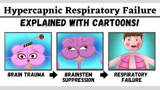 Hypercapnic type 2 respiratory failure explained with cartoons [upl. by Arekahs]