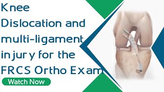 Knee Dislocation and multiligament injury for the FRCS Ortho Exam  Orthopaedic Academy [upl. by Ulrike]