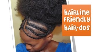 45 Hairline Friendly Hairstyles  Braided Headband [upl. by Rolph]