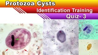 Protozoa Cysts Identification Training Quiz  Part 3 [upl. by Kahlil56]