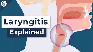 Why Do You Lose Your Voice  Laryngitis Explained [upl. by Margareta]