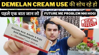 demelan cream review  demelan cream best pigmentation cream  how to remove pigmentation amp darkspot [upl. by Rednasela62]