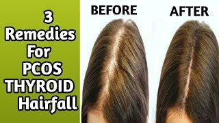 3 Home Remedies for hair fall hairfall due to PCOS pcod and thyroidRachna Reviews [upl. by Akcinehs479]