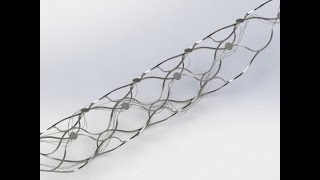 Brain stent to let five paralysed people control exoskeleton [upl. by Noirod]