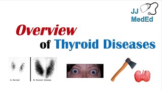 Overview of Thyroid Diseases Hashimoto’s Graves’ Sick Euthyroid Syndrome Toxic adenoma etc [upl. by Foley]