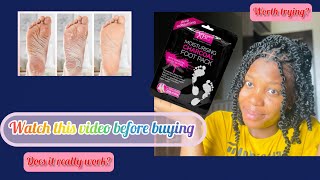 How to use XBC moisturizing charcoal foot pack Is it worth trying Did it work for me find out😍 [upl. by Maher]