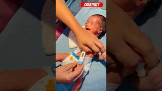 Newborn Baby Checked Temperaturenicu medical baby viral [upl. by Enirhtak]