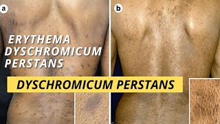 Dyschromicum Perstans EDP [upl. by Hserus]