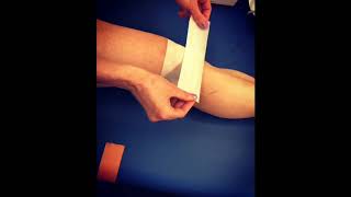 How to Relieve Chondromalacia Patella with McConnell Taping [upl. by Ahkihs]