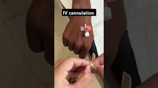 IV Cannulation TechniquemedicalytshortsViralshortsMedicalPracticeandTalks [upl. by Aramahs]