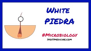 White Piedra  Microbiology [upl. by Eila]