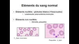 HEMATOLOGIE Anomalies de la Numération Formule Sanguine NFS  Hémogramme [upl. by Dorree709]