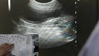 Optimising your ultrasound image [upl. by Dedra]