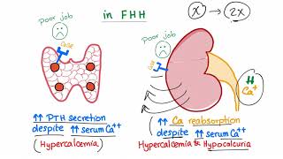 Familial Hypocalcuric Hypercalcemia FHH  Endocrinology and Nephrology [upl. by Delilah]