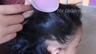 ASMR Lice and Nits Removal for Ultimate Scalp Check  Satisfying [upl. by Nnylyma]