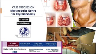 Multinodular Goitre for Thyroidectomy  Case Discussion  Kerala ISA PG Refresher Course 2021 [upl. by Amasa]