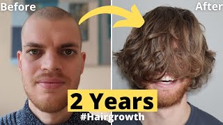 💇🏻💈Hair Growth Time Lapse 2 Years 24 Months Men  From Buzz Cut [upl. by Eyar]