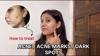 How to treat acne  dark spots  pimples 💕 Remove Dark Spots Pigmentation amp Pimples ✨ [upl. by Yklam]