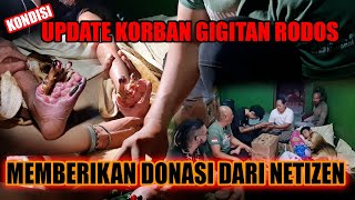 UPDATE SI BAIM KORBAN GIGITAN RODOSRANJAU DARATGIBUG  MEMBERIKAN DONASI DARI NETIZEN [upl. by Vania]