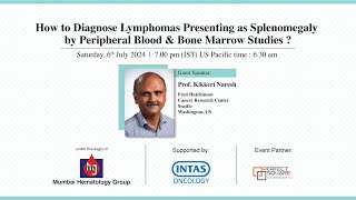 How to diagnose lymphomas presenting as splenomegaly by peripheral blood amp bone marrow studies [upl. by Hightower390]