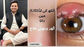 Stye In Eyelid  Ankh main Dana Banna  Eye Heath Hub [upl. by Ymaral]