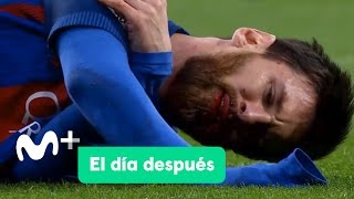 El Día Después 24042017 El Clásico de Messi [upl. by Nuahsyt692]