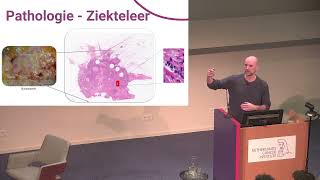 Lezing Hugo Horlings over AI in de Pathologie [upl. by Virgy]