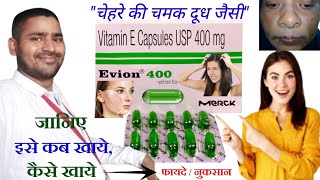 evion 400 for skin  evion 400 capsule for hair  evion 400 khane ke fayde  evion 400 uses in hindi [upl. by Friedly]