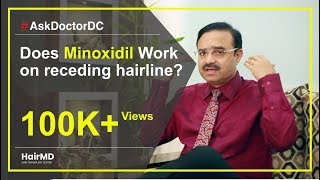 Does Minoxidil Work On Receding Hairline  HairMD Pune  In HINDI [upl. by Tillie]