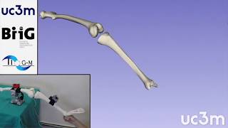 Knee joint goniometry using MARG lowcost sensors [upl. by Ahseenal822]