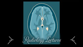 How to perform Thyroid Ultrasound [upl. by Dorrehs]