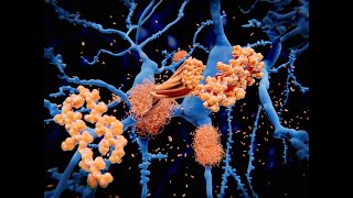 What are the new Dementia drugs targeting Cunningcast DementiaActionWeek alzheimerssociety [upl. by Attenov]