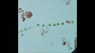 Microspora cells becoming flagellated Zoospores  real time [upl. by Aleacim988]