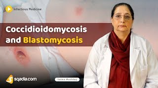 Coccidioidomycosis and Blastomycosis  Internal Medicine Infectious Disease  VLearning [upl. by Talyah96]