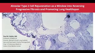 10102024  Alveolar Type 2 Cell Rejuvenation as a Window into Reversing Progressive Fibrosis [upl. by Kcim846]