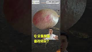 Q2942사진처럼 붉게 오돌토돌하게 올라왔는데사진처럼 붉게 오돌토돌하게 올라왔어요 번진거같아요 왜그러는걸까요  연고 발라도 나아지지 않아요피부염나비한의원🦋 [upl. by Acim]