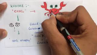 Lysosomal storage diseases mnemonic  USMLE  NEETPG  AIIMS [upl. by Ailisab]