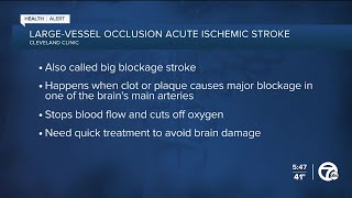 Strokes happening more in younger people Cleveland Clinic research explains why [upl. by Euqinorev931]