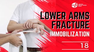 SG FIRST AID LOWER ARM IMMOBILIZATION 18 [upl. by Eberly]