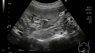 Ultrasound Video showing the fetus who was attempted for abortion [upl. by Cooke]