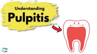 What is Pulpitis  Endodontics [upl. by Uyerta]