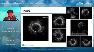 2024 8th COACT CTO DAY SESSION4 [upl. by Nakre]