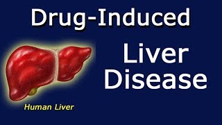 DrugInduced Liver Disease [upl. by Selrahcnhoj]