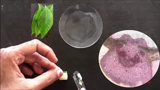 Adhatoda Vasaka Leaf  How to Do Section Cutting amp Microscopy of Vasaka Leaf  सेक्शन कटिंग ऑफ़ लीफ [upl. by Rothschild]