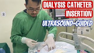 Dialysis catheter insertion  pemasangan CDL catheter double lumen [upl. by Augustine945]